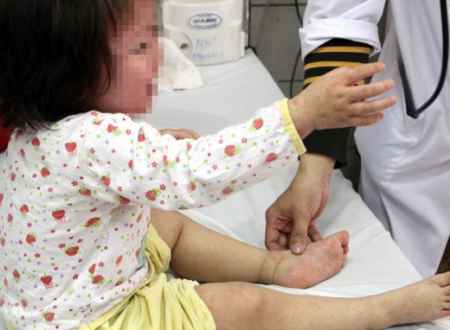 Cần theo dõi trẻ thường xuyên để phát hiện sớm