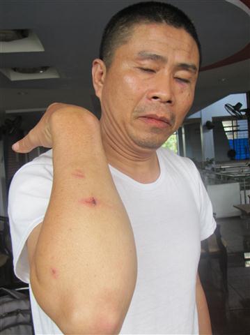 Anh Kim với những vết thương bị các đối tượng gây ra