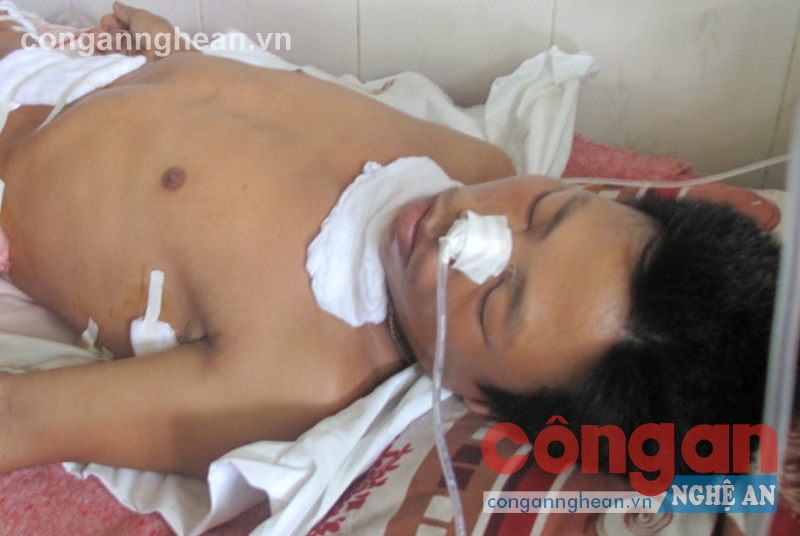 Nạn nhân đang điều trị tại Bệnh viện Đa khoa Tân Kỳ
