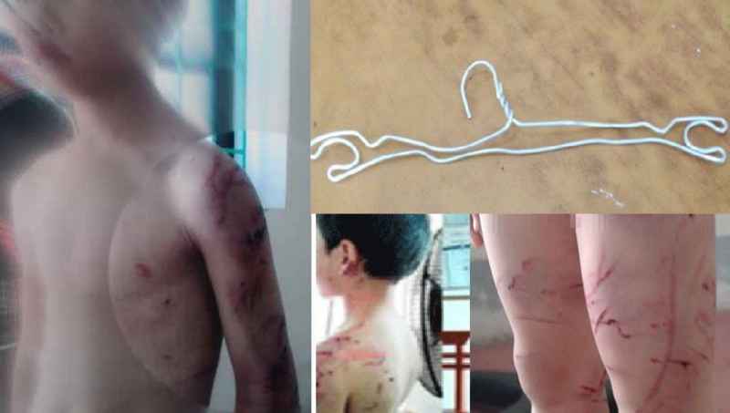 Vật dụng Trà dùng đánh con và những vết thương tích trên cơ thể cháu N