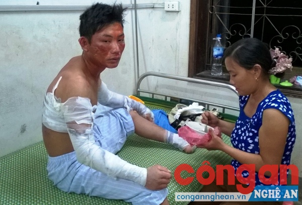 1 trong 4 nạn nhân trong vụ nổ đang được điều trị tại Bệnh viện Đa khoa khu vực Tây Bắc