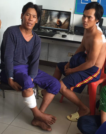 Hai ngư dân bị thương