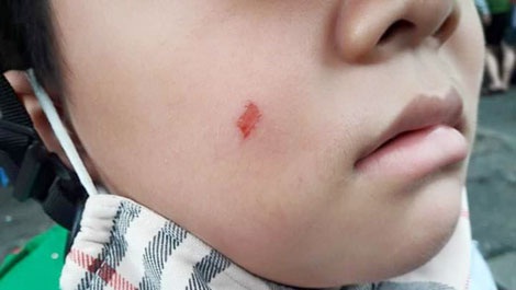Vì một học sinh trường tiểu học Đức Trí bị giáo viên chủ nhiệm làm 