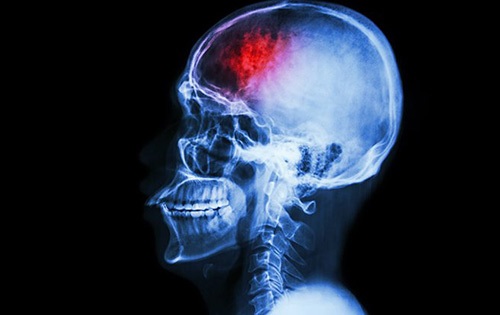 Vi khuẩn ruột liên quan đến những căn bệnh thuộc về não (Ảnh: Shutterstock).
