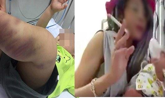 Cơ thể bé A đầy những vết thâm tím (trái) và “Hot girl ăn quỵt” Bella hút thuốc phả khói vào mặt đứa con sơ sinh