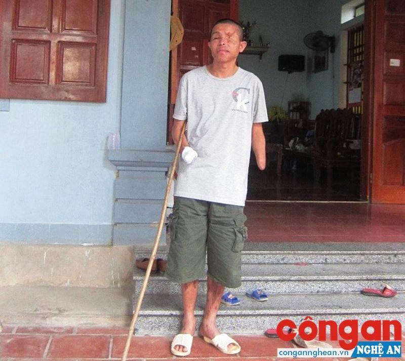 Anh Thái Viết Hảo, nạn nhân của một món hàng                             được gửi kèm trên xe khách