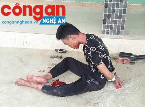 Sau khi giết vợ, Mong tự sát nhưng không thành
