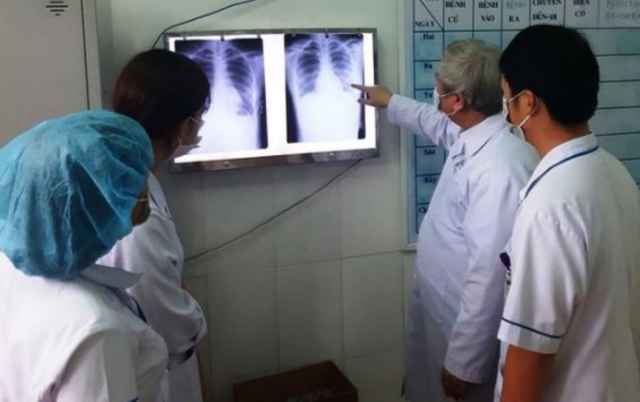 Các bác sĩ phân tích phim XQuang của bệnh nhân nhiễm Covid19.
