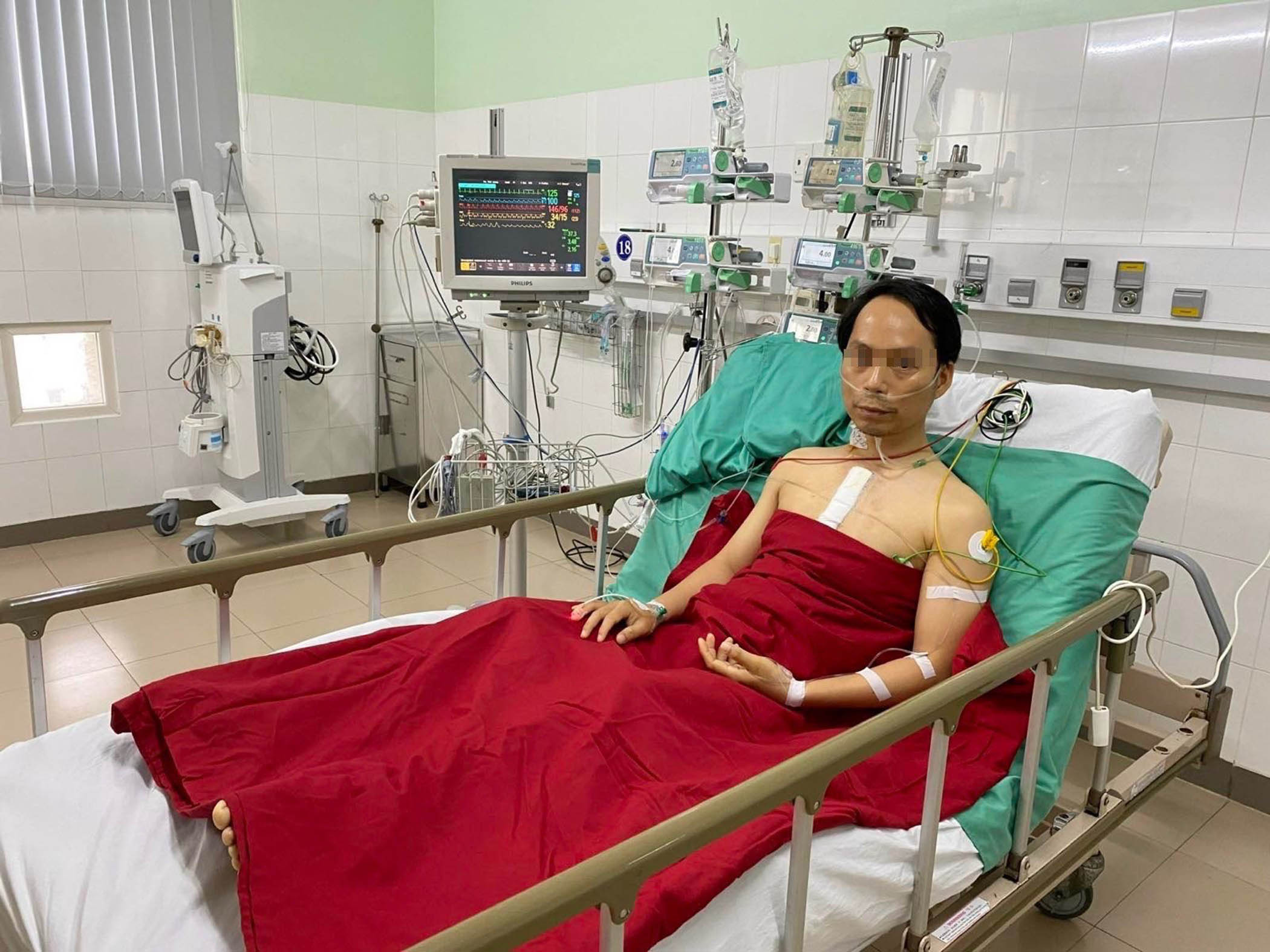 Bệnh nhân Trần Quang H. (34 tuổi, ở Thừa Thiên - Huế) được ghép tim từ ca hiến tạng vào sáng 5/12 đã dần hồi phục (ảnh Bệnh viện Trung ương Huế cung cấp).