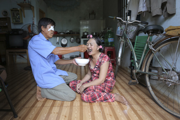Vừa đi điều trị vết thương ở mắt về, ông Hải vẫn gắng gượng chăm sóc vợ.  