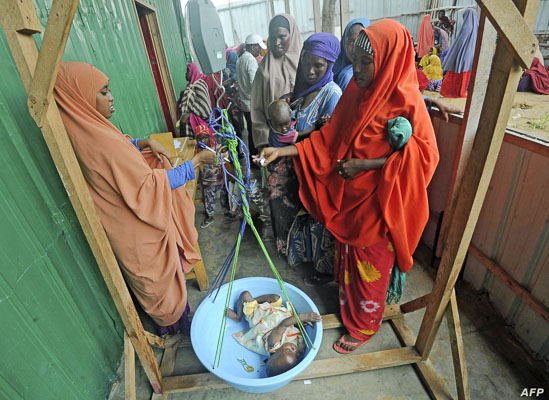 Trẻ em bị suy dinh dưỡng điều trị tại một trung tâm y tế ở ngoại ô Mogadishu, Somalia. 