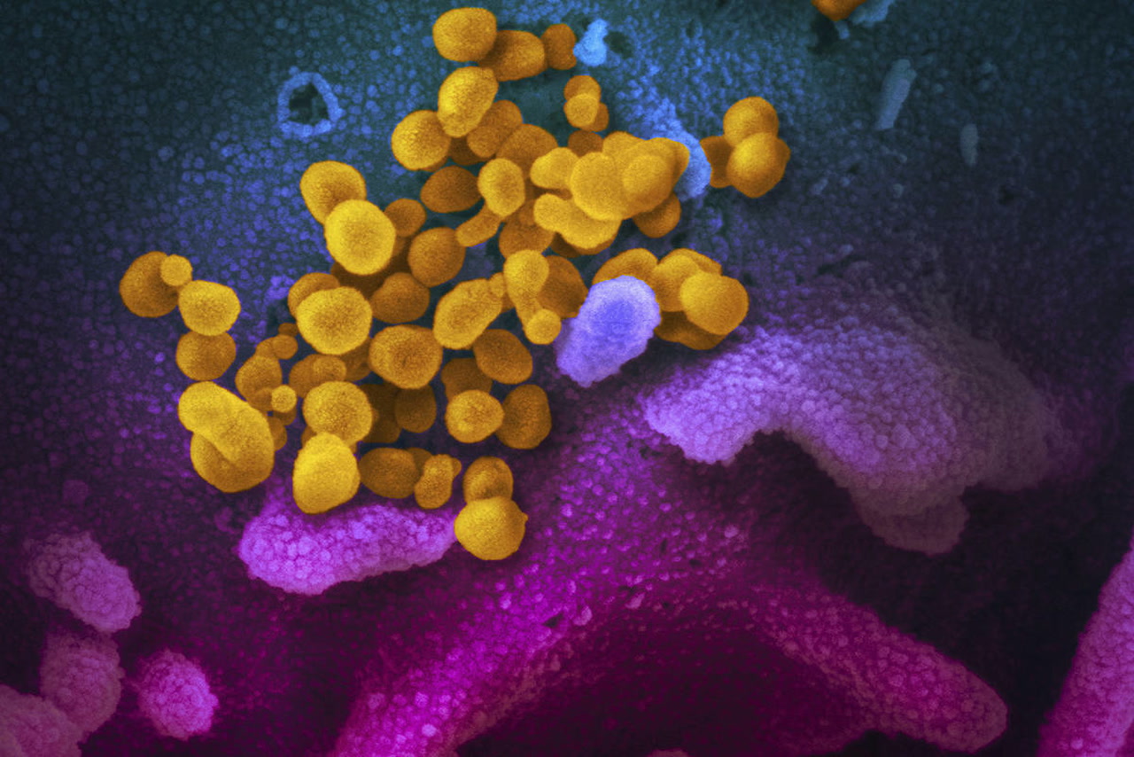 Phát hiện 1 enzyme trong máu dẫn dắt virus SARS-CoV-2 xâm nhập các tế bào
