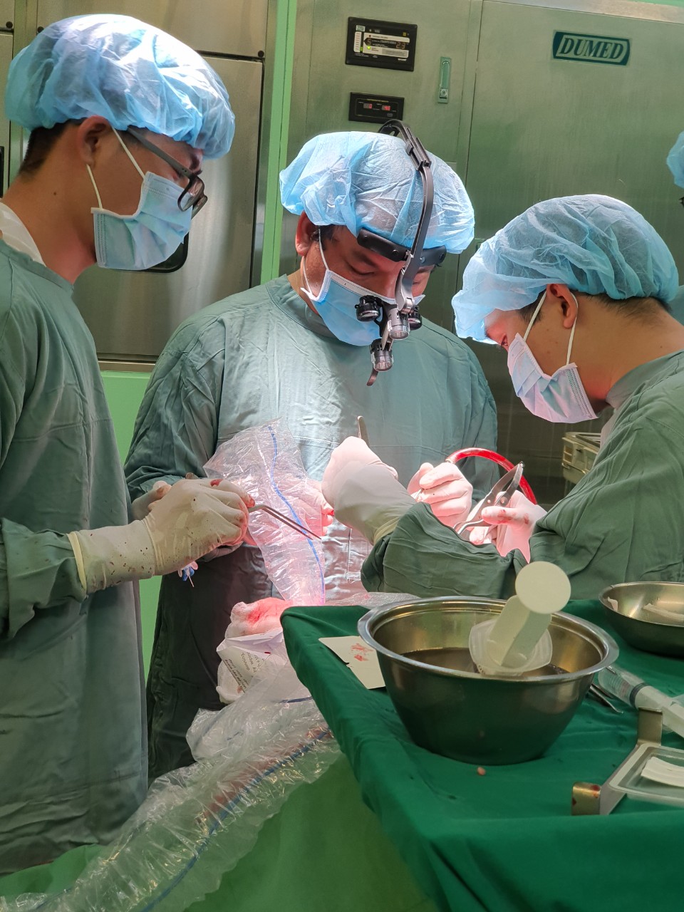 Các bác sĩ thực hiện ca phẫu thuật khối u màng não khổng lồ vùng trán. Ảnh: Bác sĩ Nguyễn Vĩnh Thọ cung cấp.