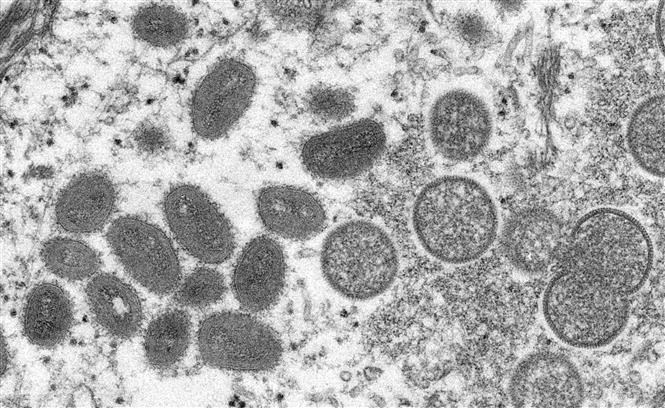 Hình ảnh virus đậu mùa khỉ dưới kính hiển vi điện tử.