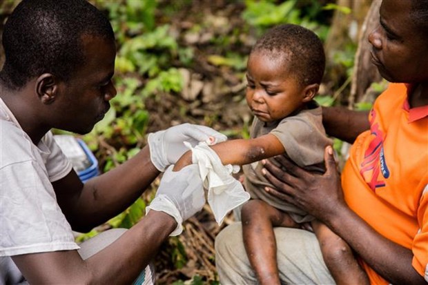 Điều trị cho bệnh nhân mắc bệnh đậu mùa khỉ  tại Zomea Kaka (Cộng hòa Trung Phi).