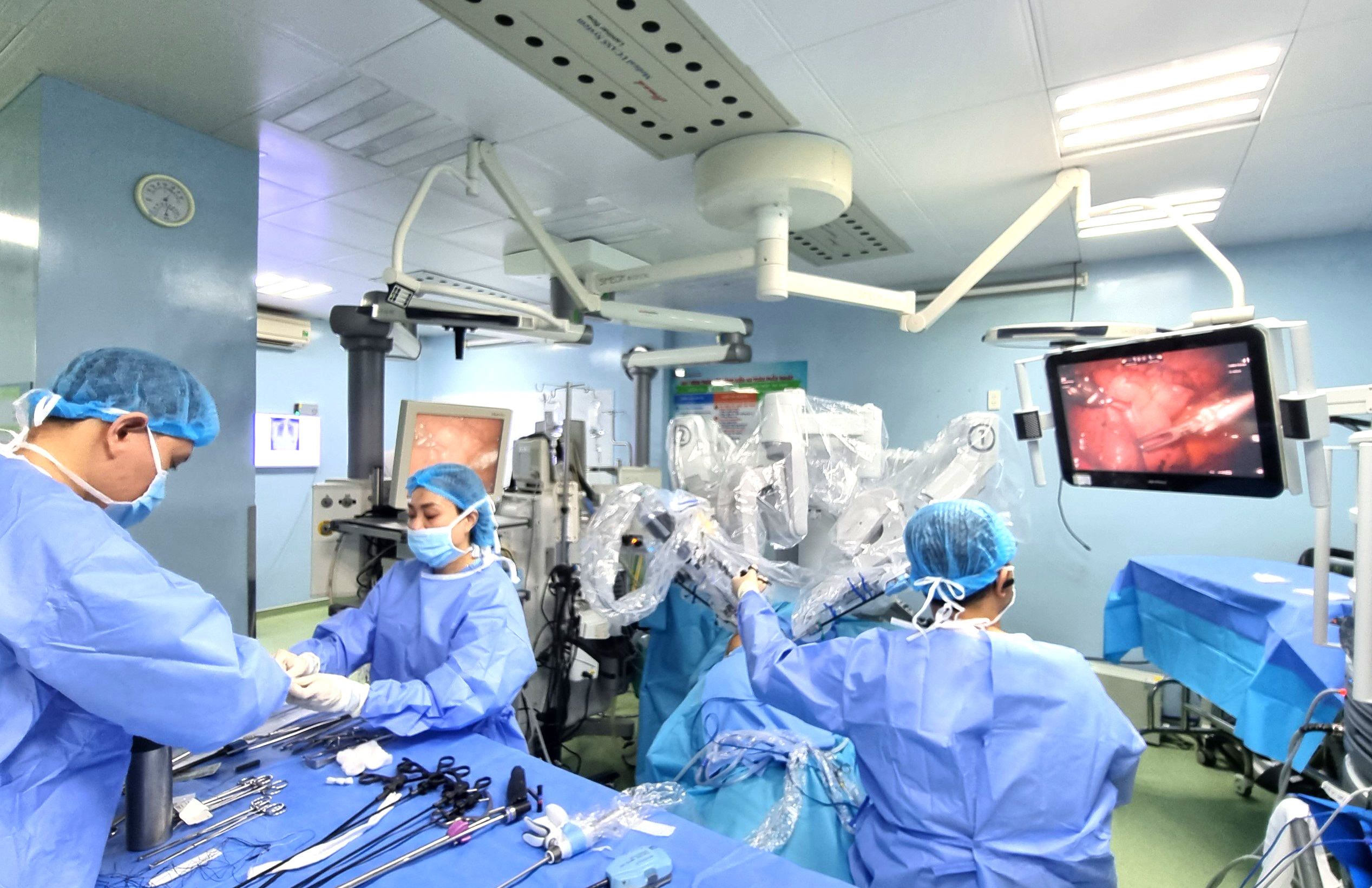 Các bác sĩ phụ phẫu thuật và hệ thống cánh tay robot đang vận hành phẫu thuật cho người bệnh.